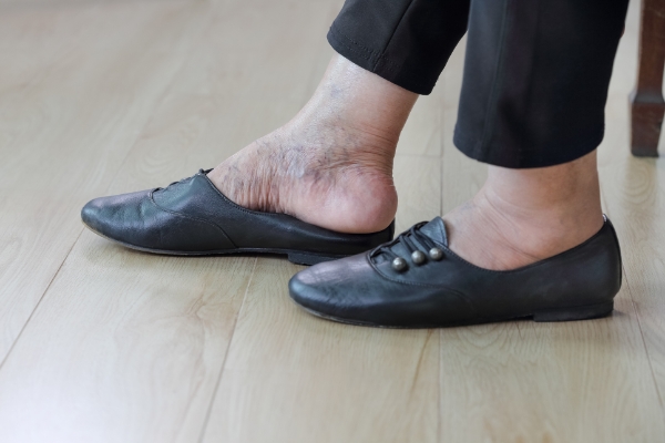 An older women's legs. She is removing one of her black shoes.